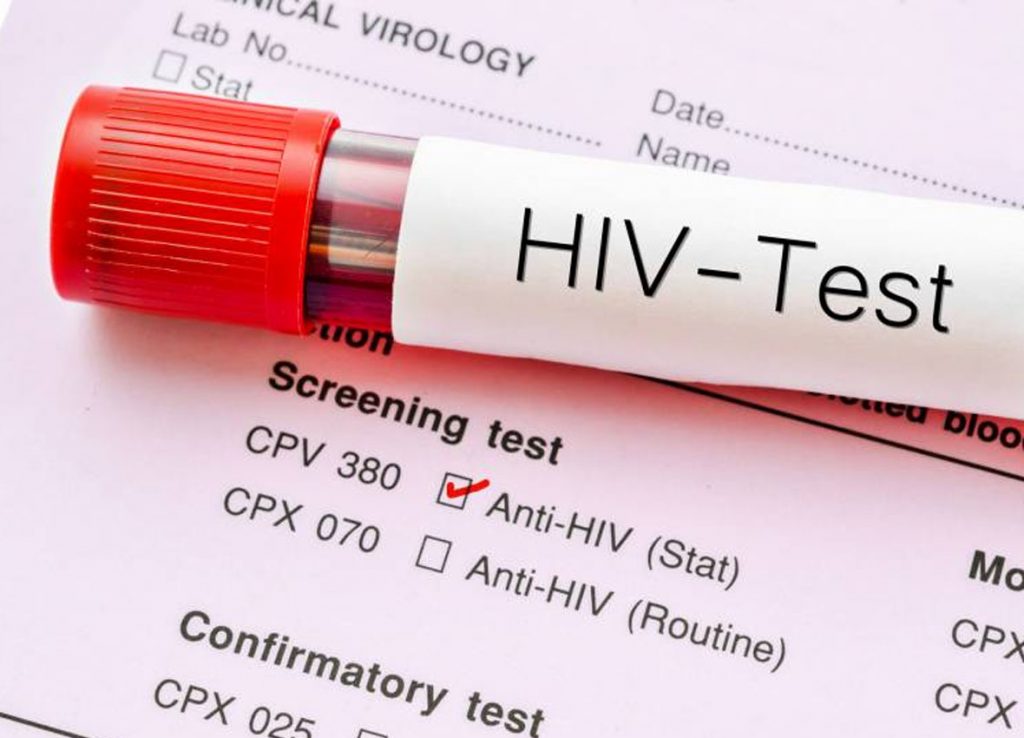 HIV TEST-2