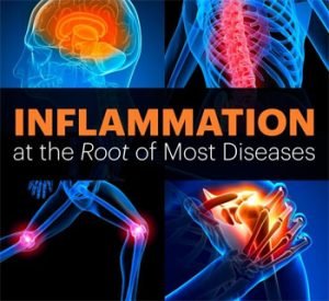 INFLAMATION